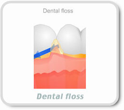 Dental Floss